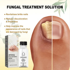 Fungal treatment solution for nails with product packaging and before-and-after image on a beige background.