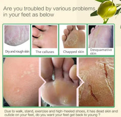 Foot care product advertisement showing foot issues and a solution.