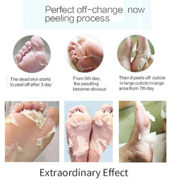 Step-by-step process of foot peeling with text indicating the effects over time.