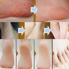Before and after comparison of skin treatment on various body parts.