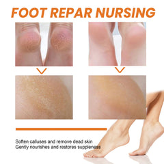 Foot repair nursing process showing before and after effects on skin.