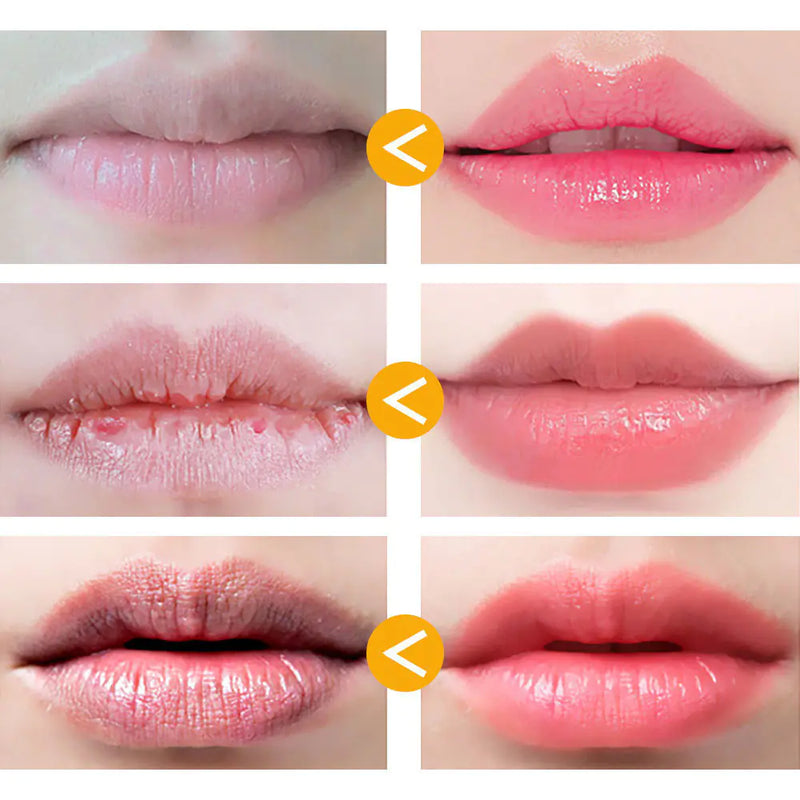Day & Night Honey Lip Treatment