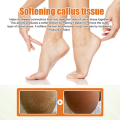 Person's feet with callus tissue being softened, text explaining the process.