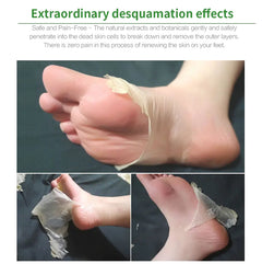 Foot with peeling skin and text about desquamation effects