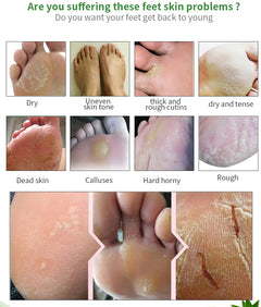 Collage of foot skin issues with text asking about foot skin problems.