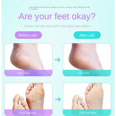 Before and after comparison of dry feet and foot calluses with a promotional message.
