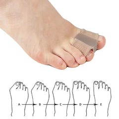 Toe alignment corrector on a foot with anticipated improvement illustrations below.